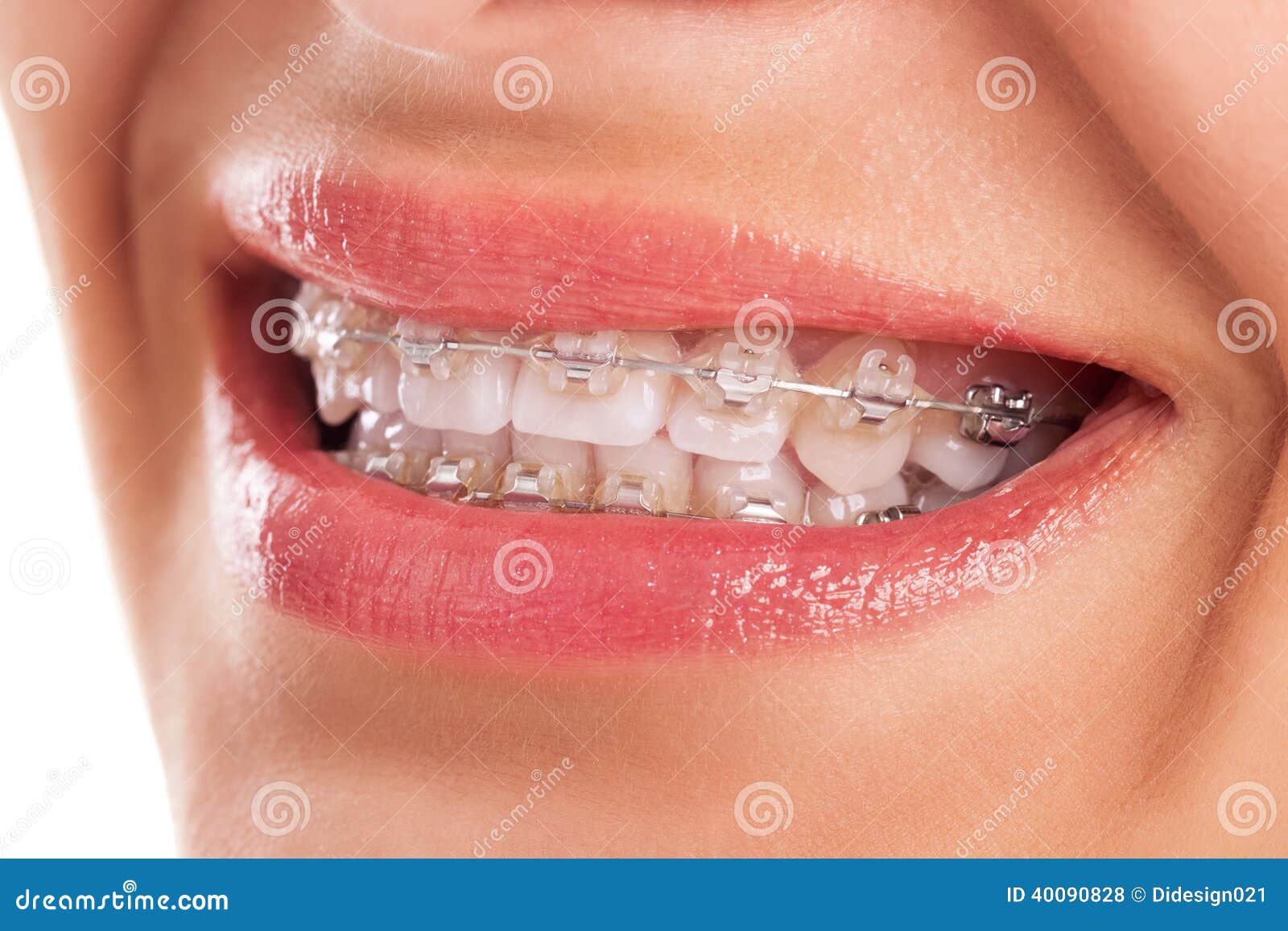 Denti Perfetti Fotografia Stock Immagine Di Gomma Prima 40090828