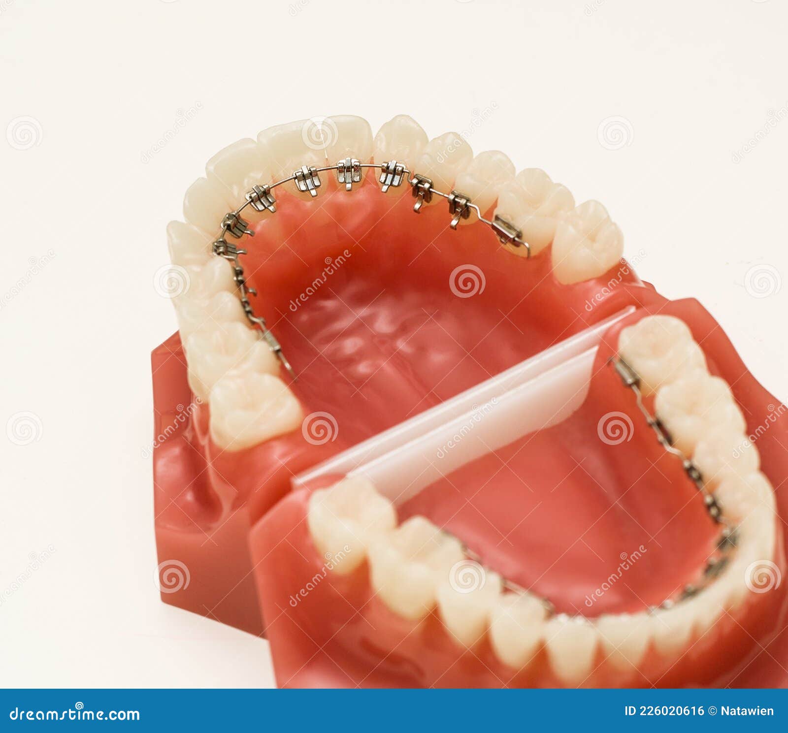 Dentist Demonstration Teeth Model of Orthodontic Bracket Stock Photo