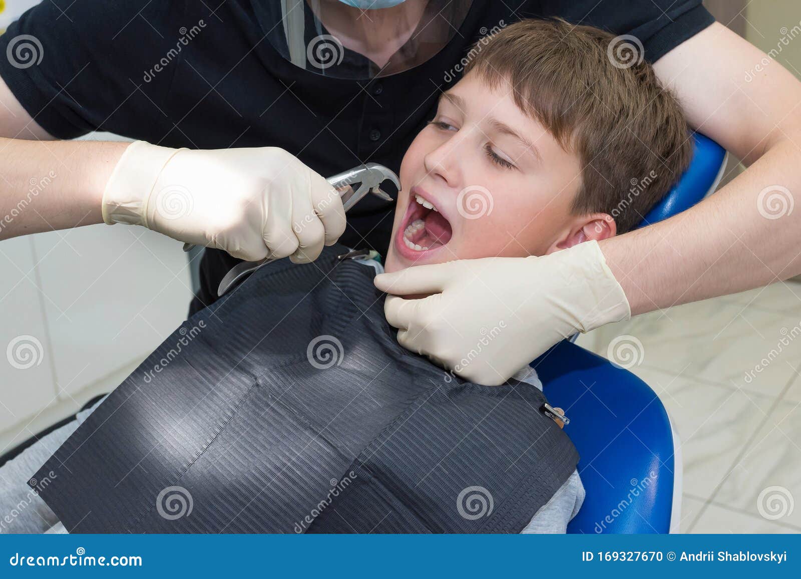 A Dentist with Dental Forceps is Pulling Out an Aching Tooth Stock