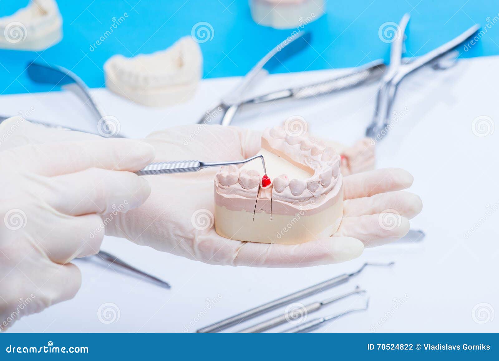 Dentist Examinates the Teeth Mold Stock Photo Image of healthy