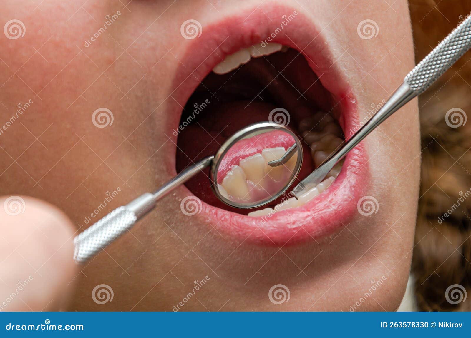 Dentist Examining Patient`s Teeth with a Dental Mirror Stock Photo Image of dentist, hygiene
