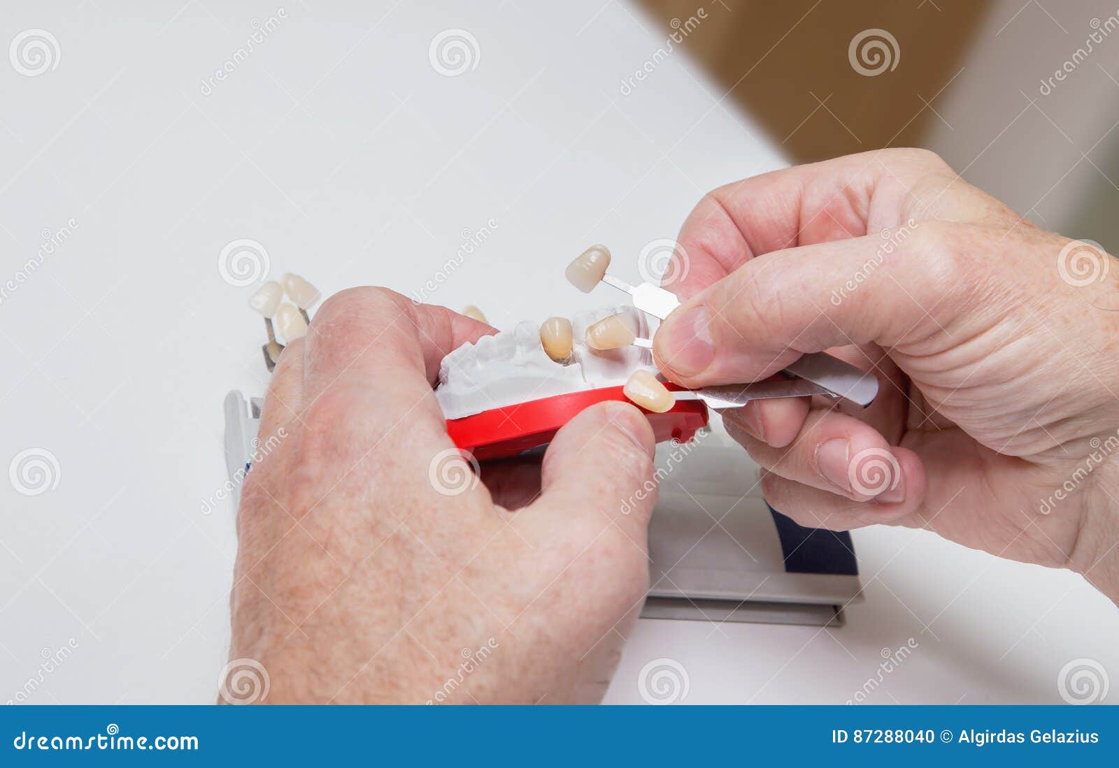 Dentist Hands with Color Guide and Plaster Model Stock Photo Image of