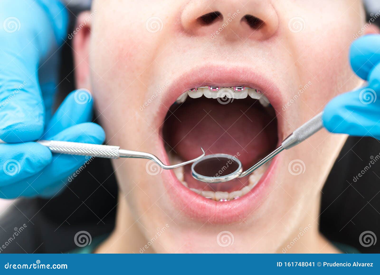 Dentist Looking and Checking Orthodontics Stock Image Image of