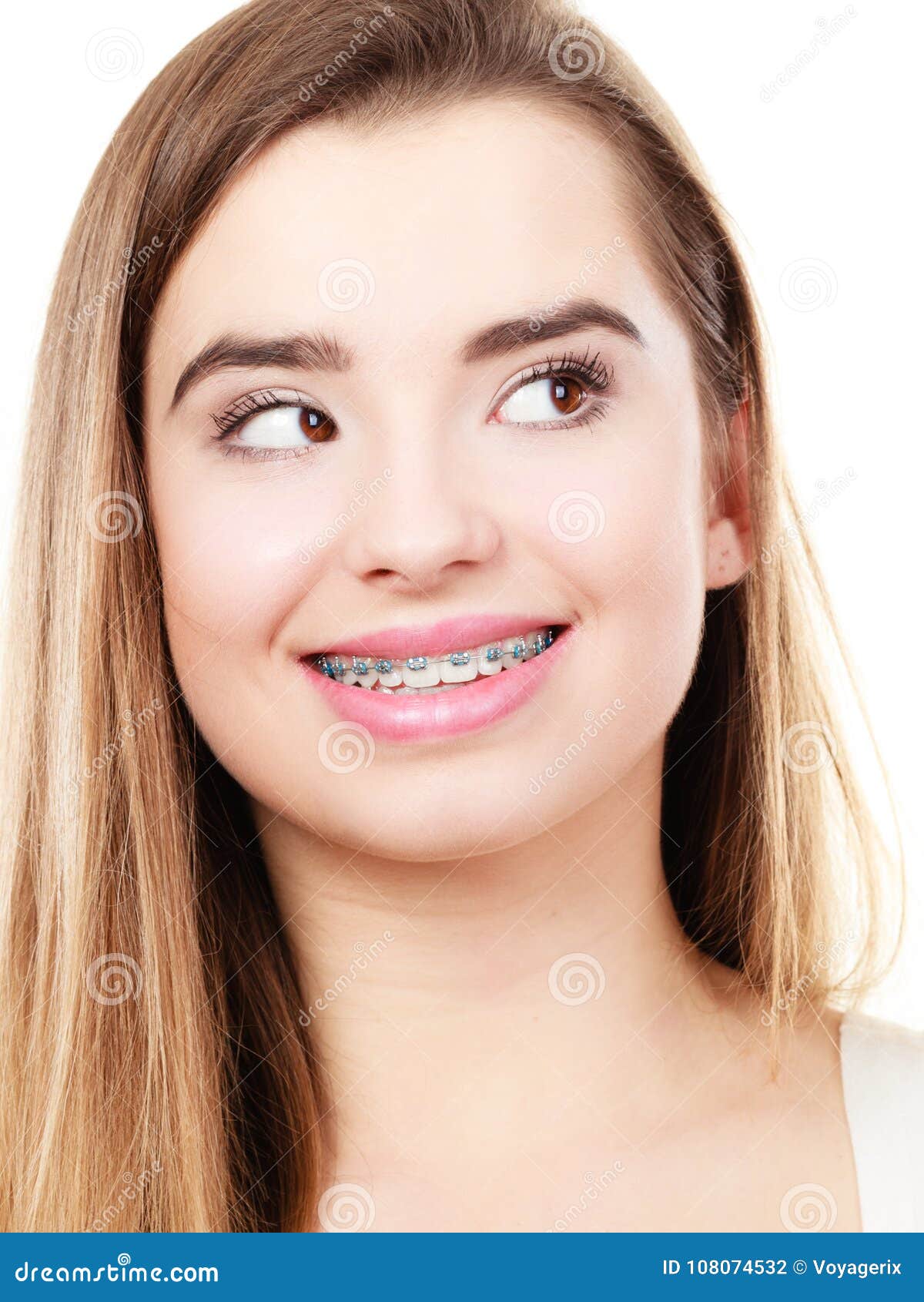 Woman Showing Her Teeth with Braces Stock Photo - Image of showing ...