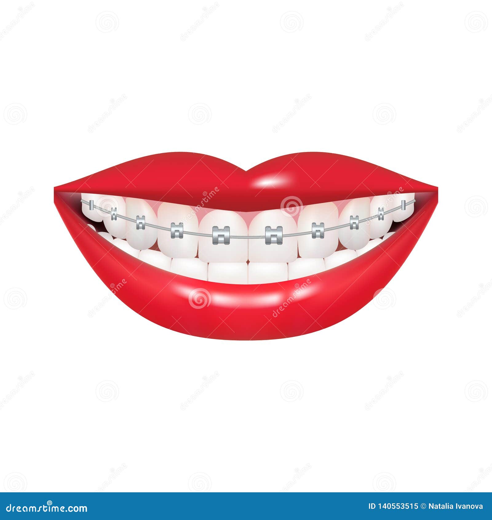 Dentist, Orthodontist. Vector Illustration. Braces on Teeth. Open Mouth