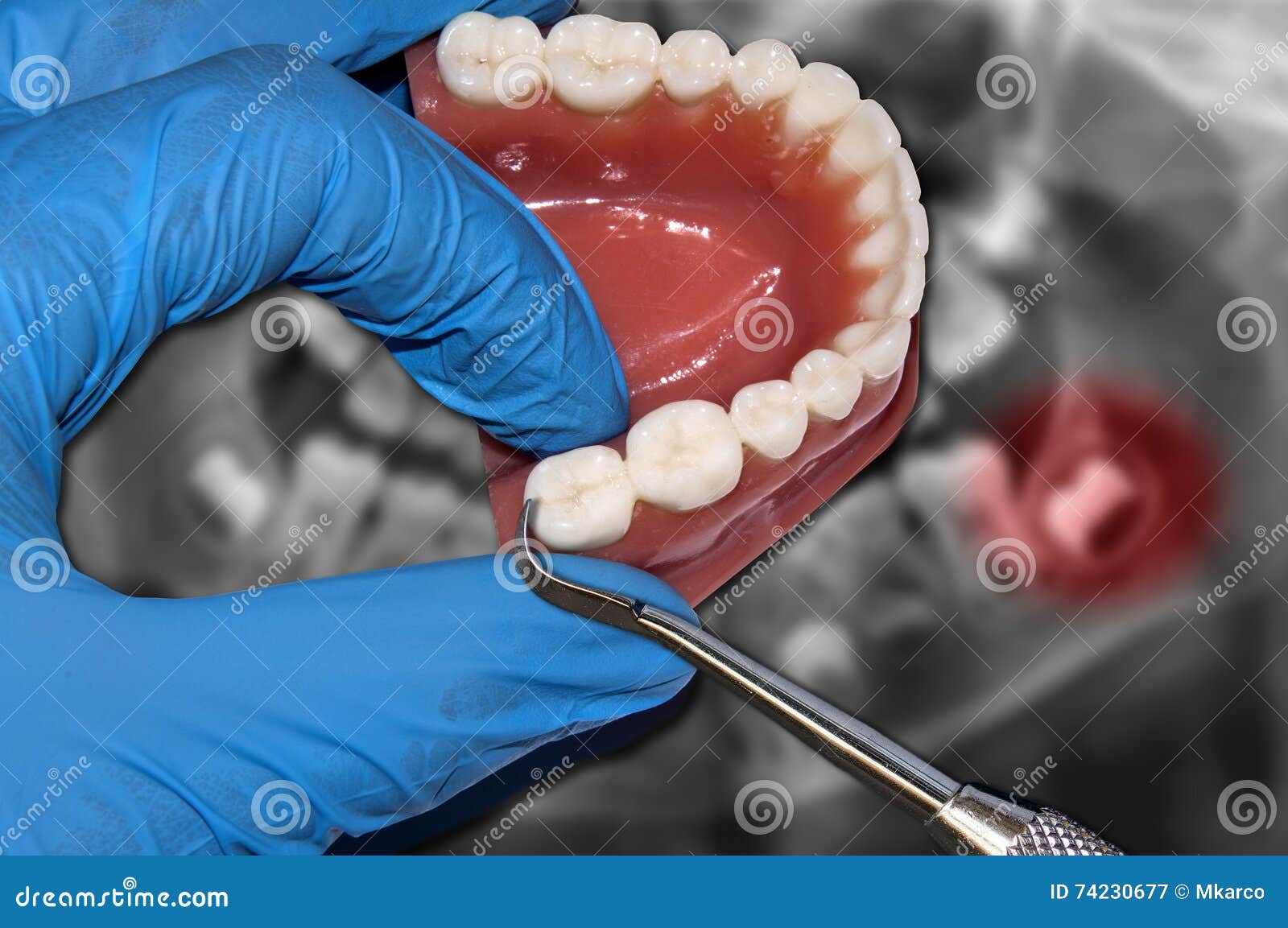 Dentist Show Molar Over Dental Teeth Model Mold Stock Image Image of