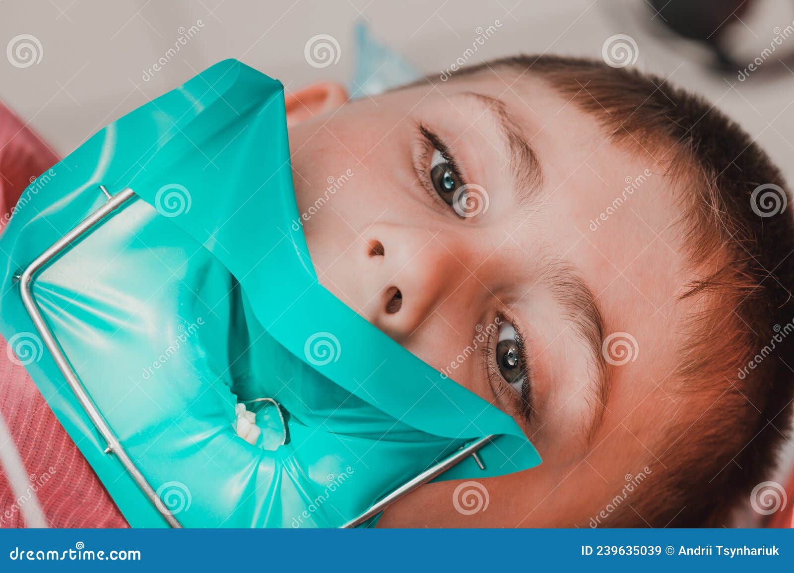 The Dentist Treats the Child S Tooth Using a Rubber Dam. Stock Image