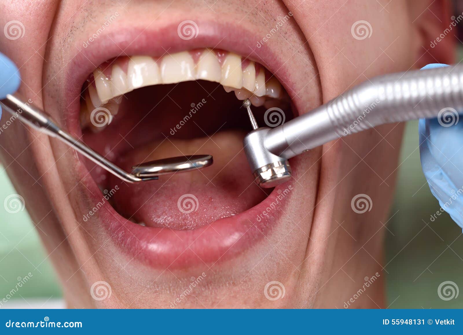 Dentist using dental drill stock image. Image of oral 55948131