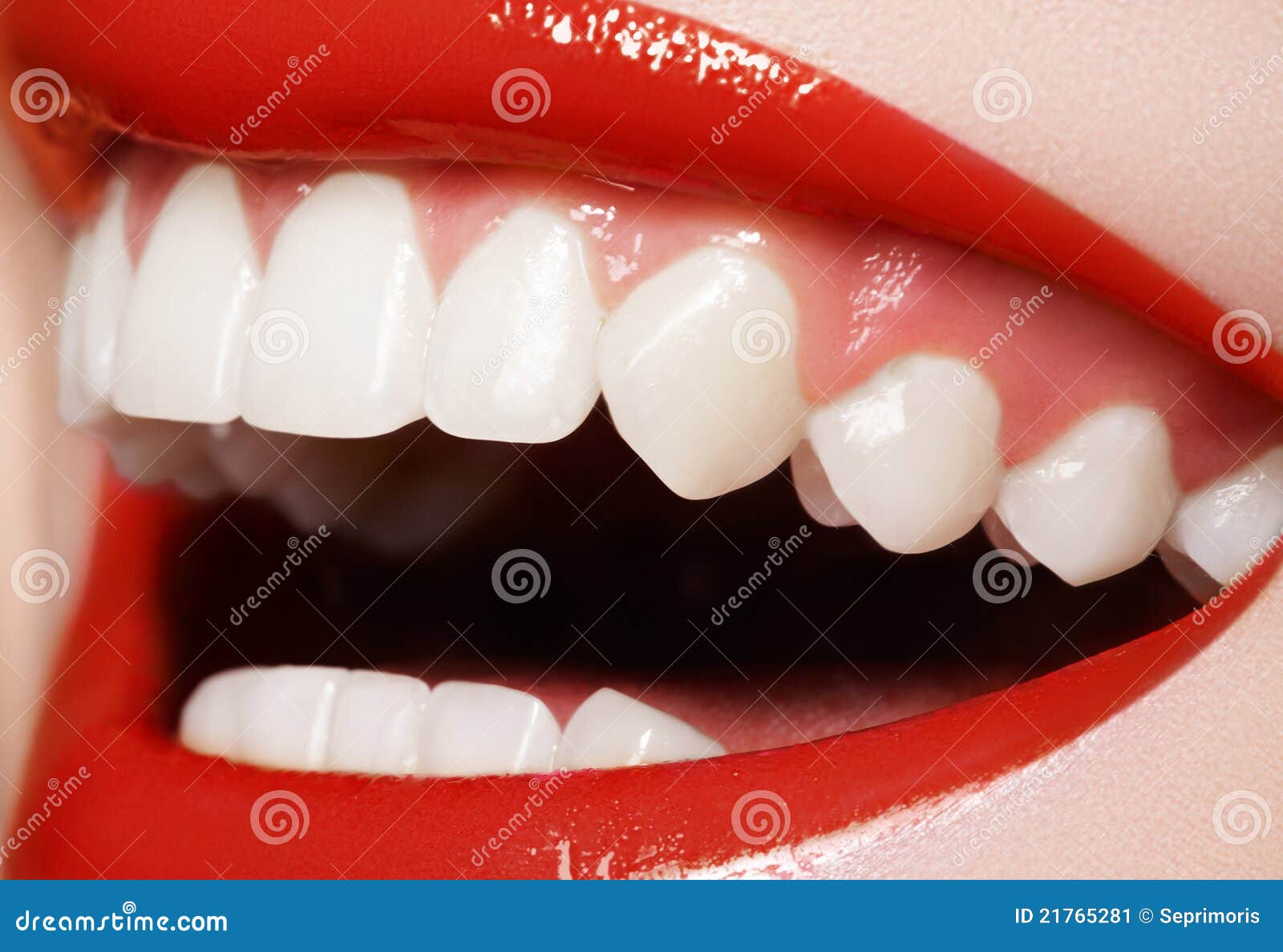 Dentistry. Happy Smile, Healthy White Teeth, Laugh Stock Image  Image 