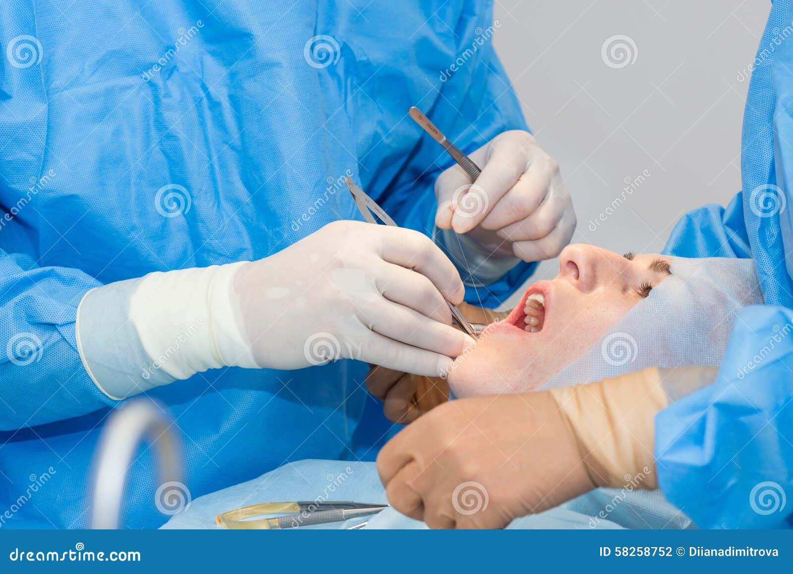Dentists during surgery stock photo. Image of hygiene 58258752