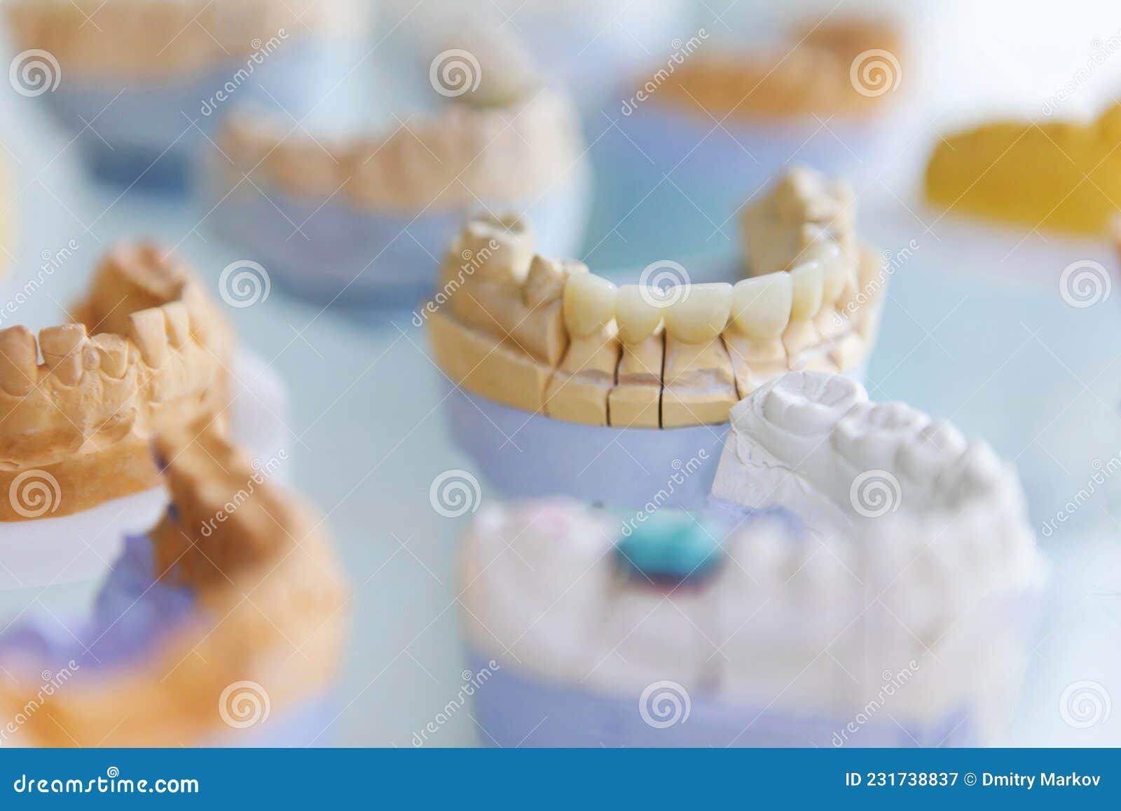 Denture Blanks in the Dental Laboratory. Many Plaster Casts with