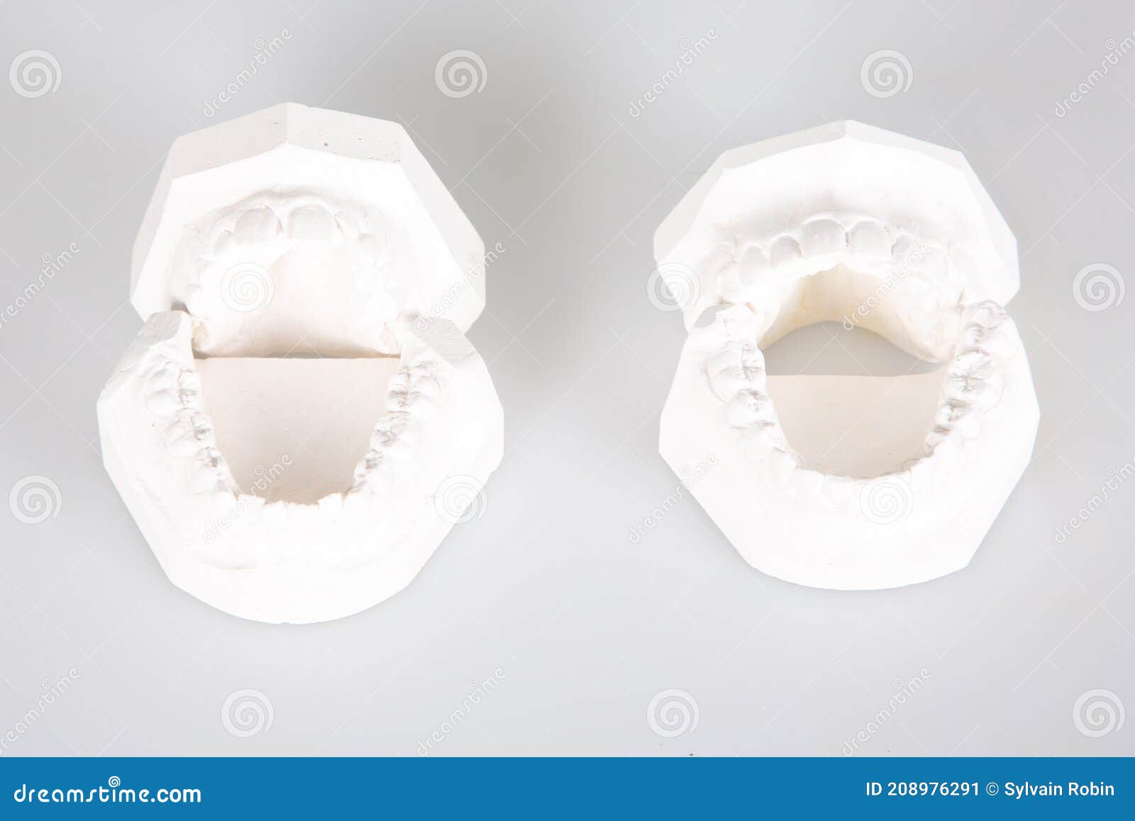 Denture Dental Implants Gypsum Print White Plaster Teeth in Dental