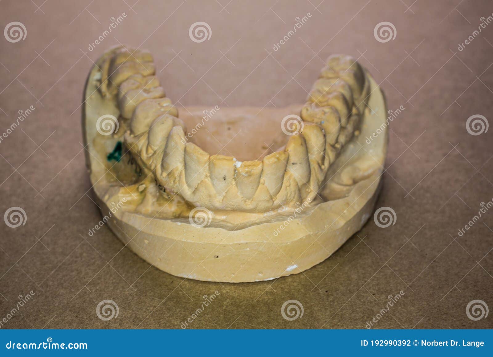 Denture Impression Made of Plaster with Implants Stock Photo Image of
