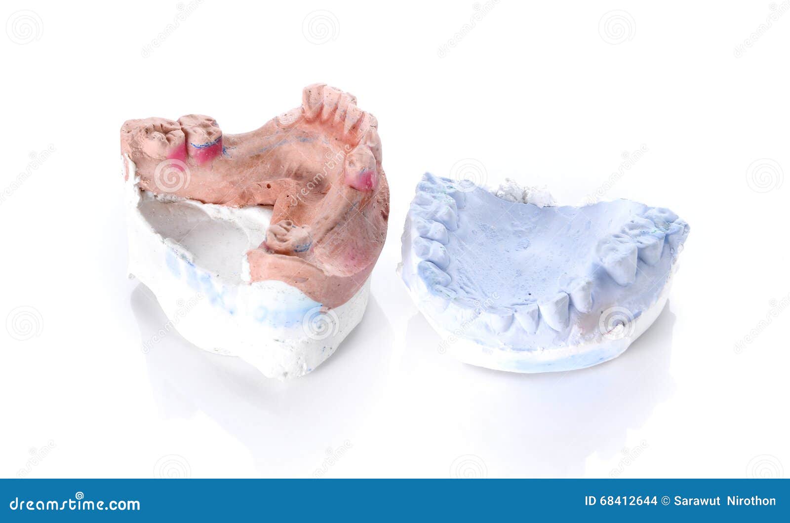 Denture Mold,broken Tooth on White Background. Stock Photo Image of