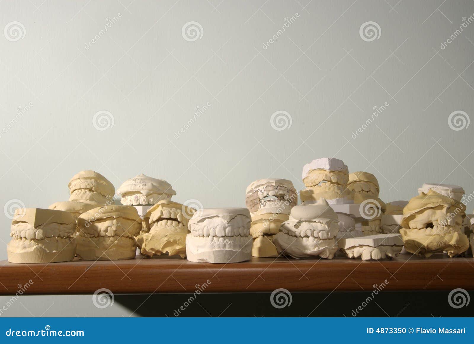 Denture plaster casts stock photo. Image of exam, lifestyle 4873350