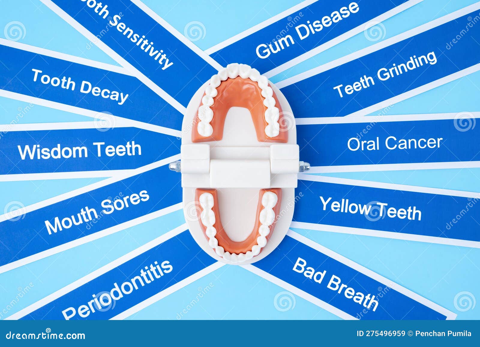 The Dentures Model with Dental Disease on Blue Background Stock Image