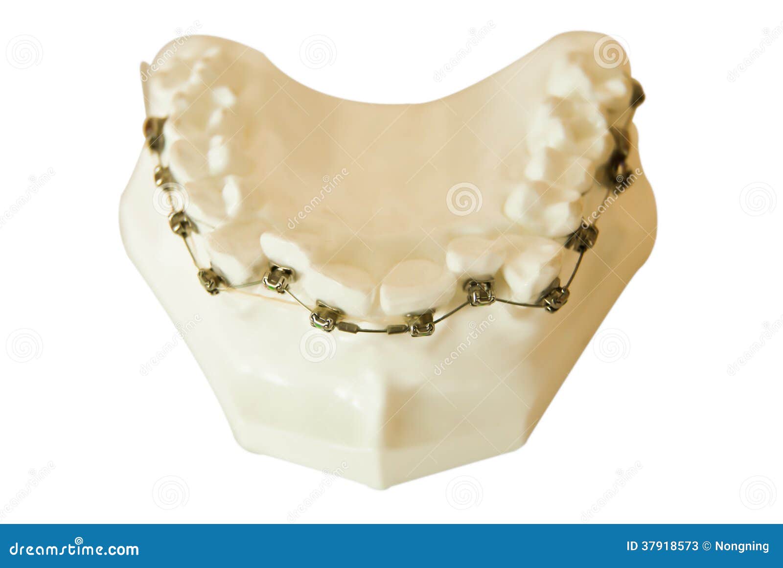 Dentures, orthodontic wire stock image. Image of orthodontist 37918573