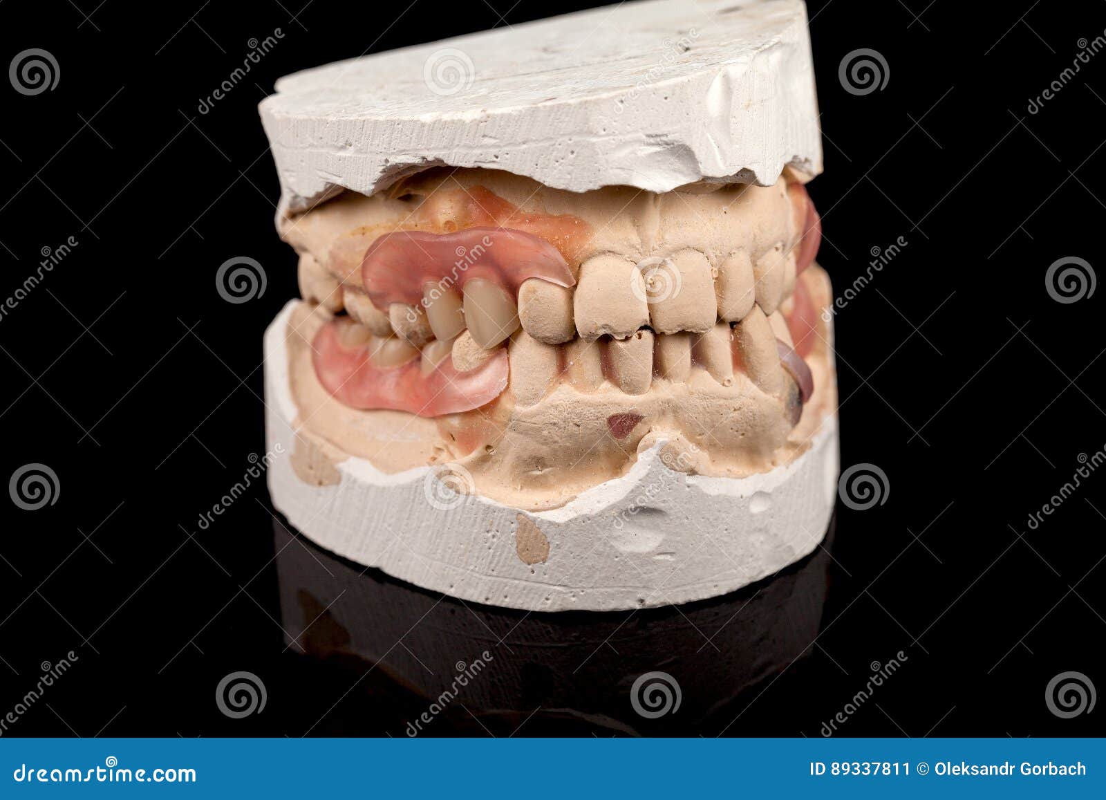 Dentures on a plaster cast stock image. Image of fake 89337811