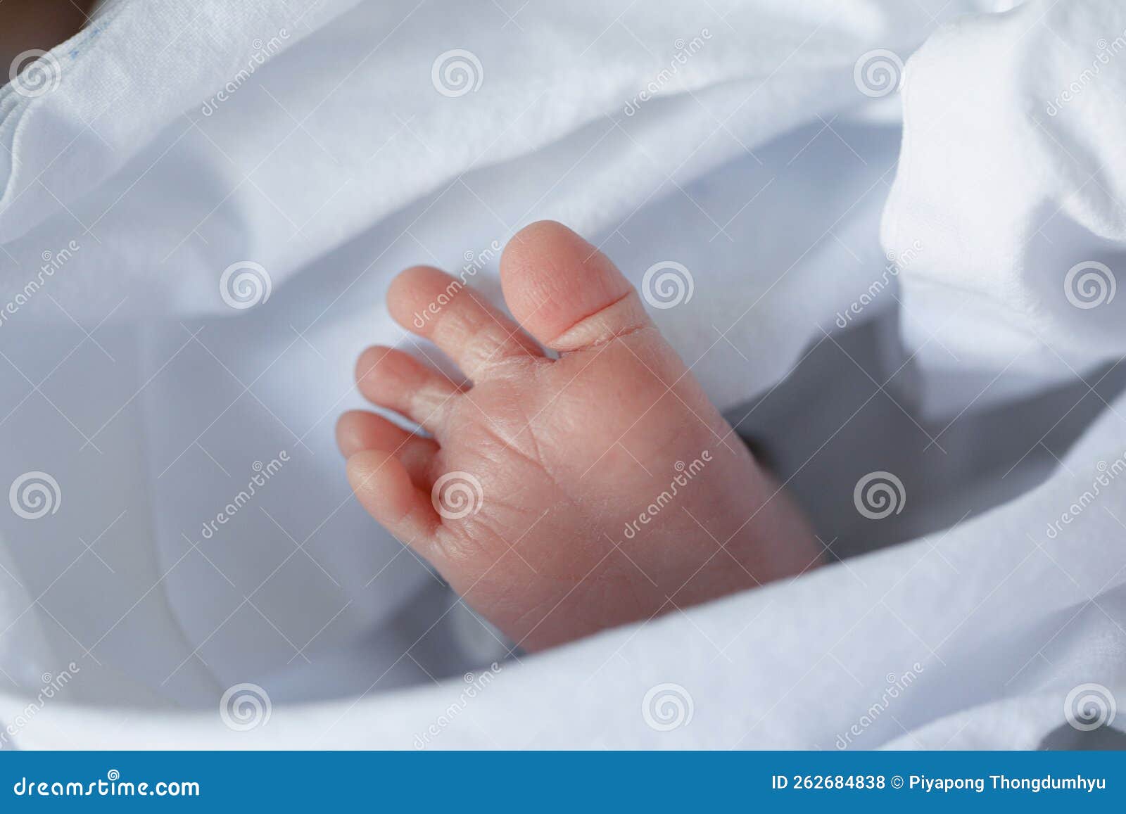 Dermatitis Small Warty Bumps Appear on the Skin in Child. Stock Photo Image of hand, body