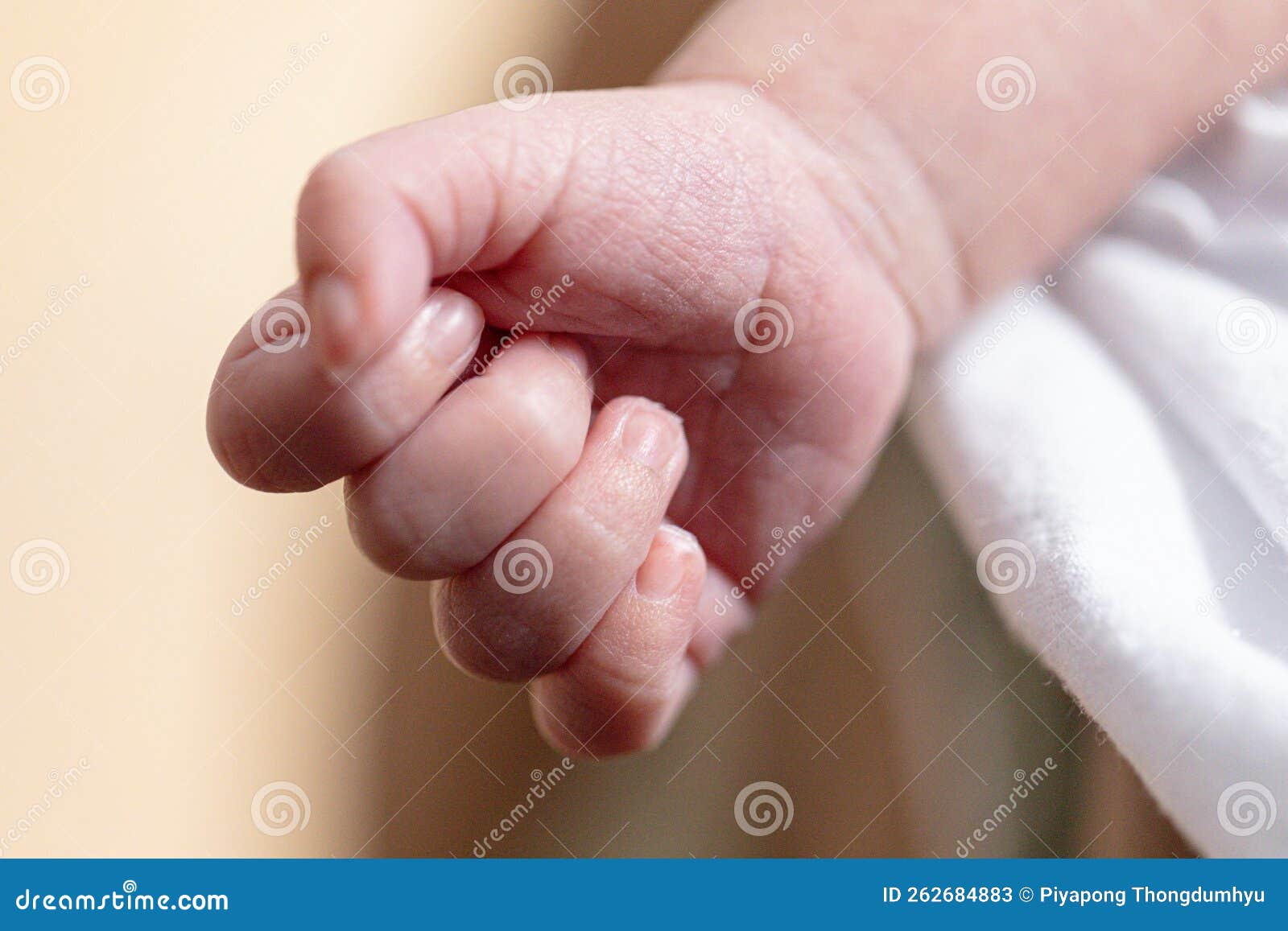 Dermatitis Small Warty Bumps Appear on the Skin in Child. Stock Image Image of hand, care