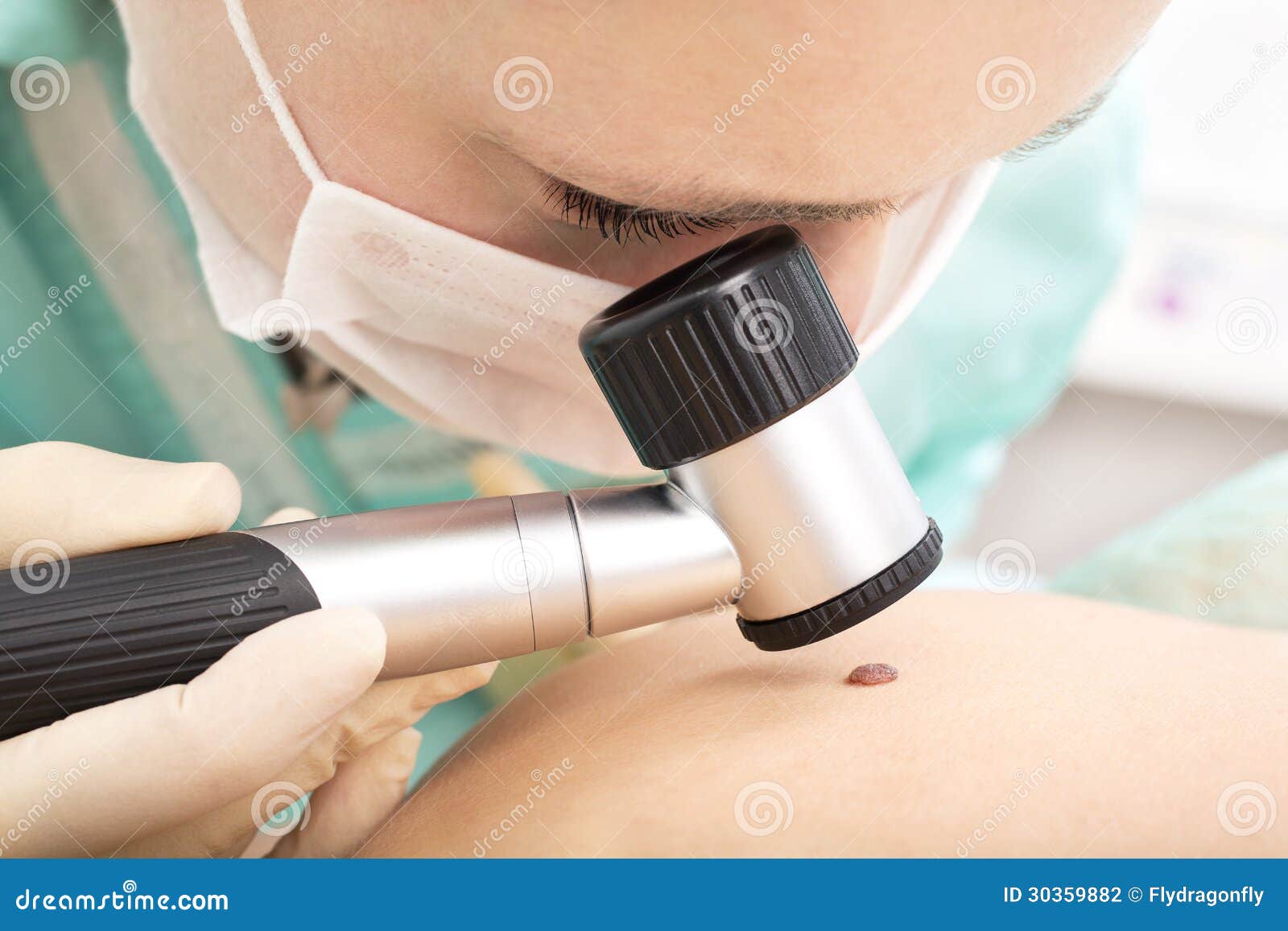 dermatologist examines birthmark with dermatoscope