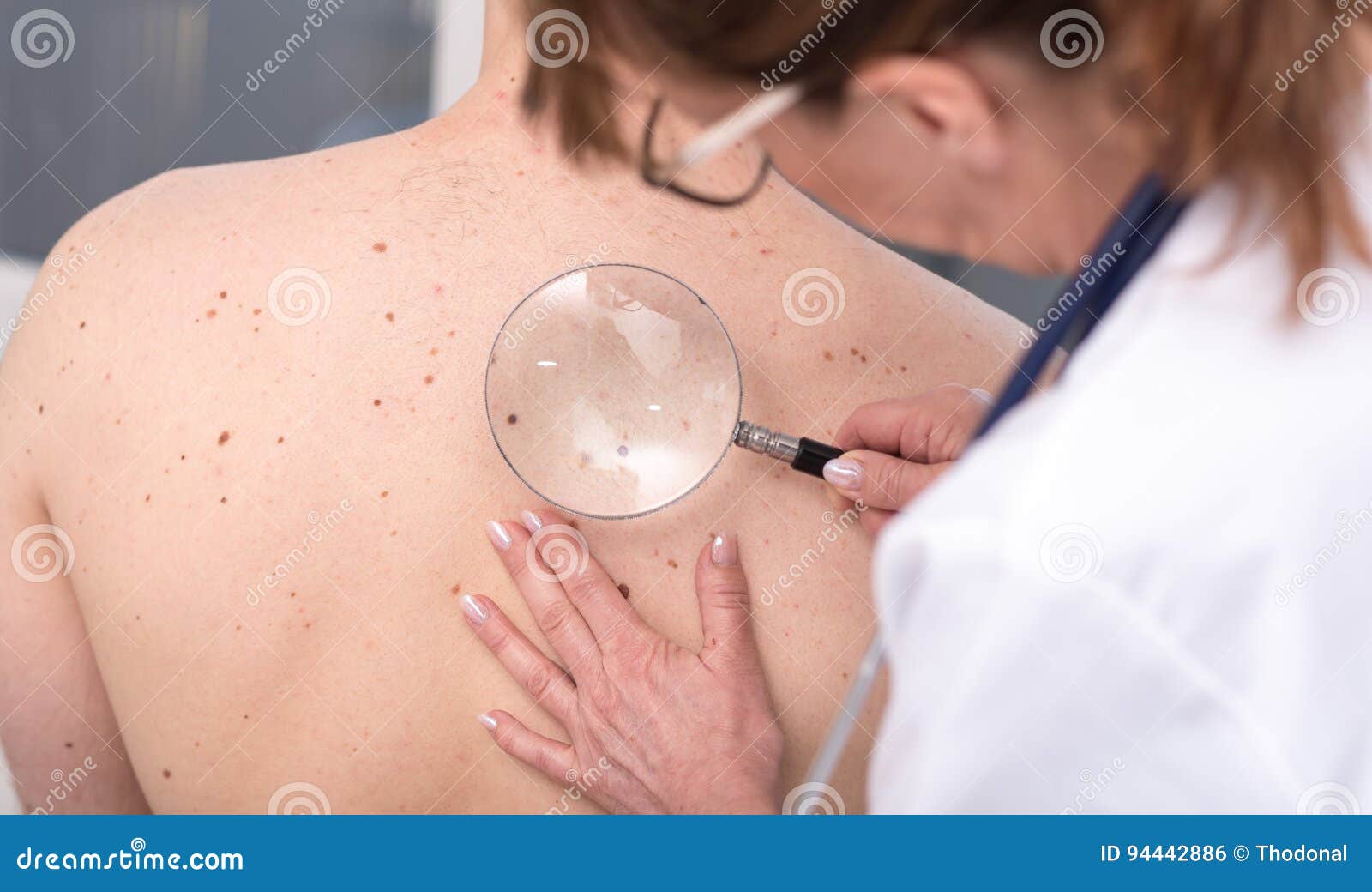 dermatologist examining the skin of a patient