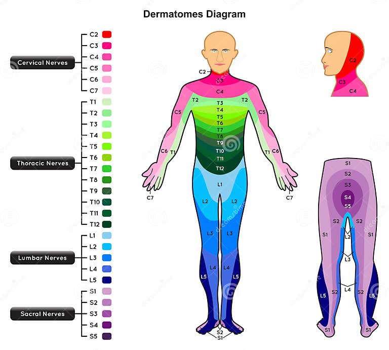 Dermatomes Diagram Infographic Stock Vector - Illustration of dermatome ...