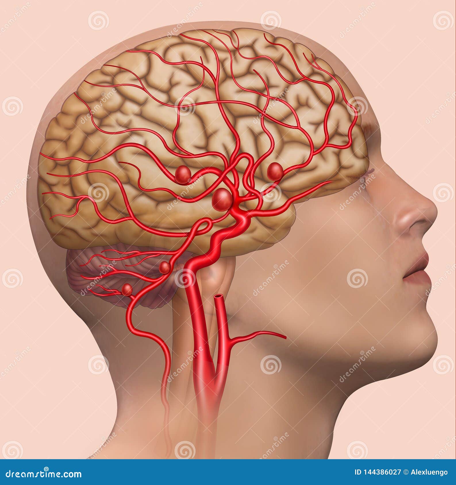 descriptive  of the development of the human cerebral aneurysm.