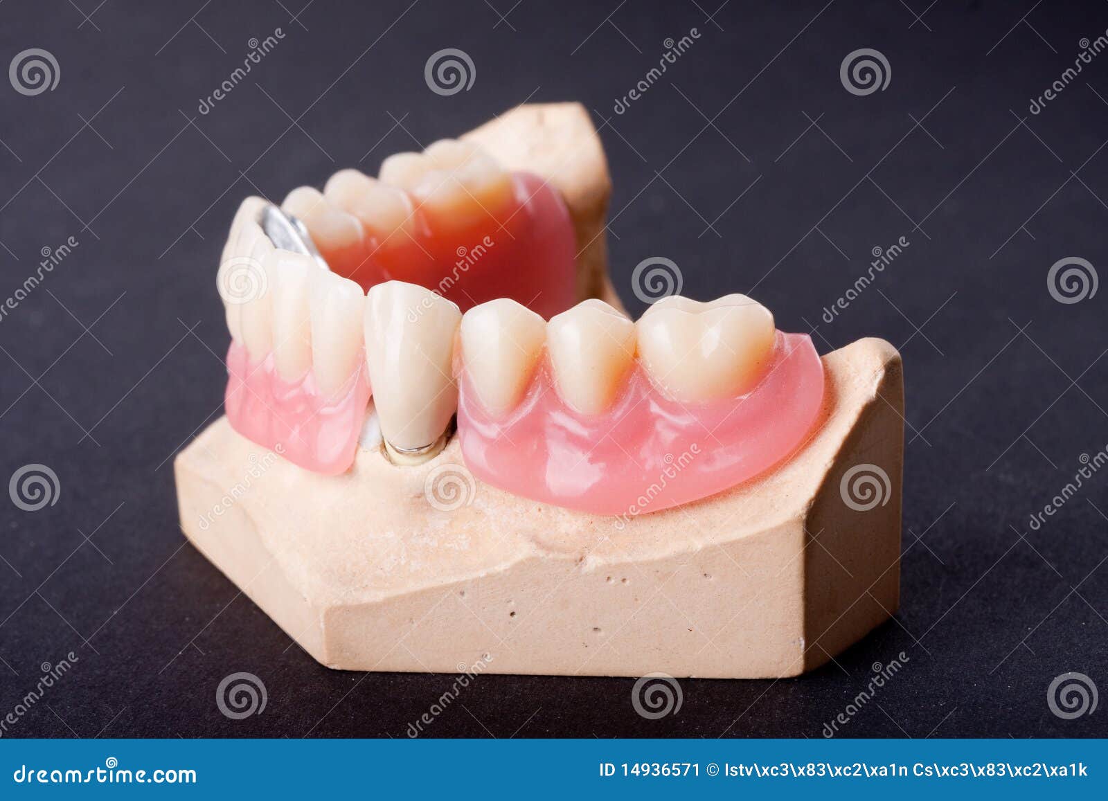 Detail dental wax model stock image. Image of modellation 14936571
