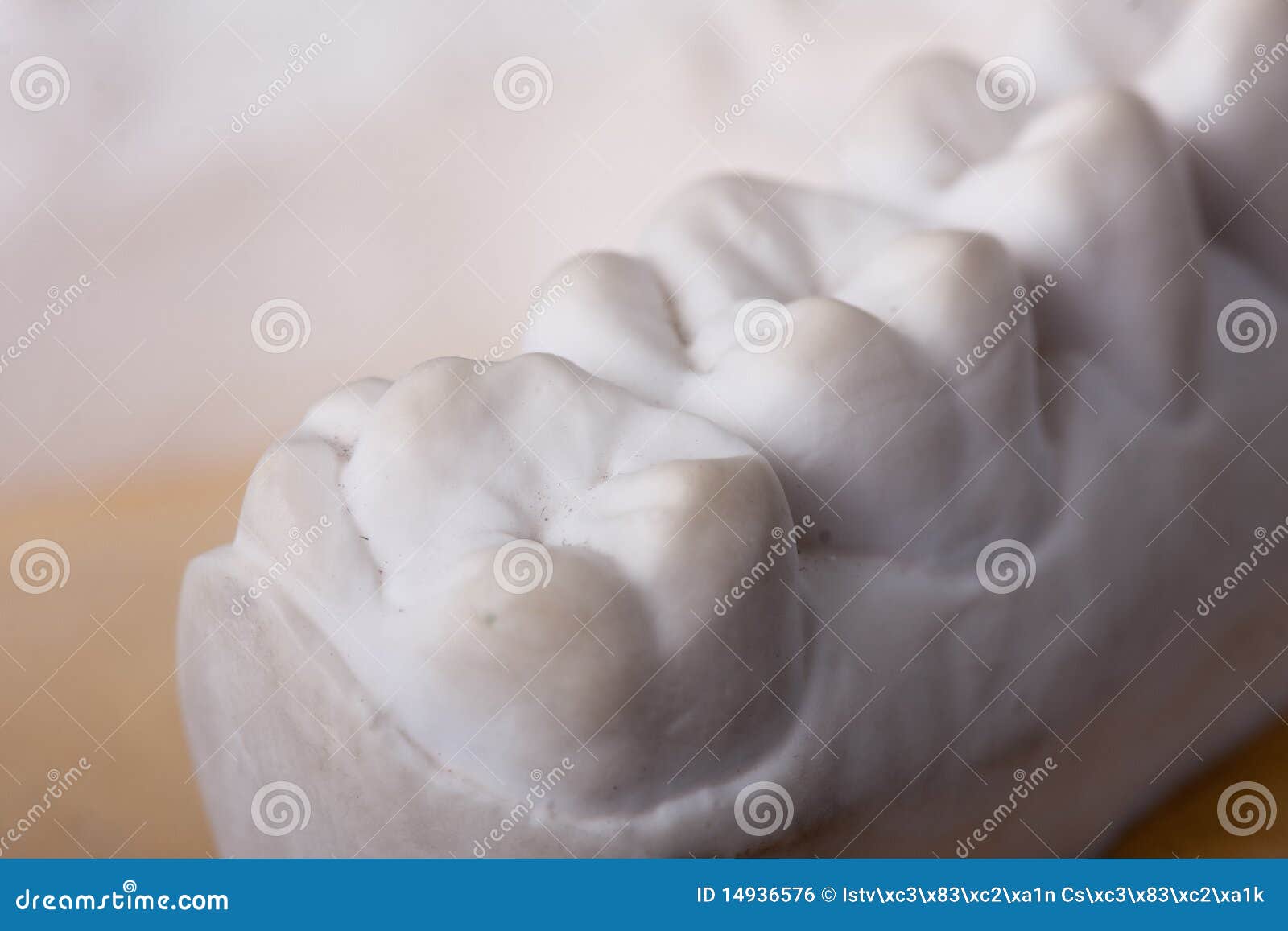 Detail Dental Wax Model Stock Photography 14936576