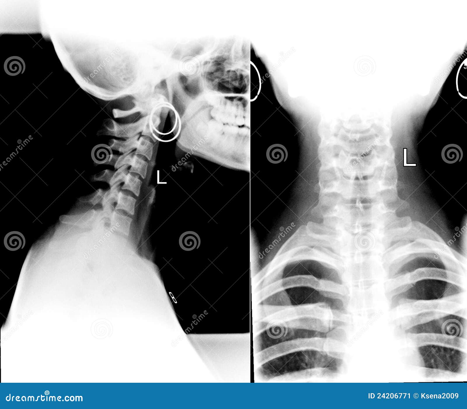 Detail Of Neck Xray Stock Image Image 24206771
