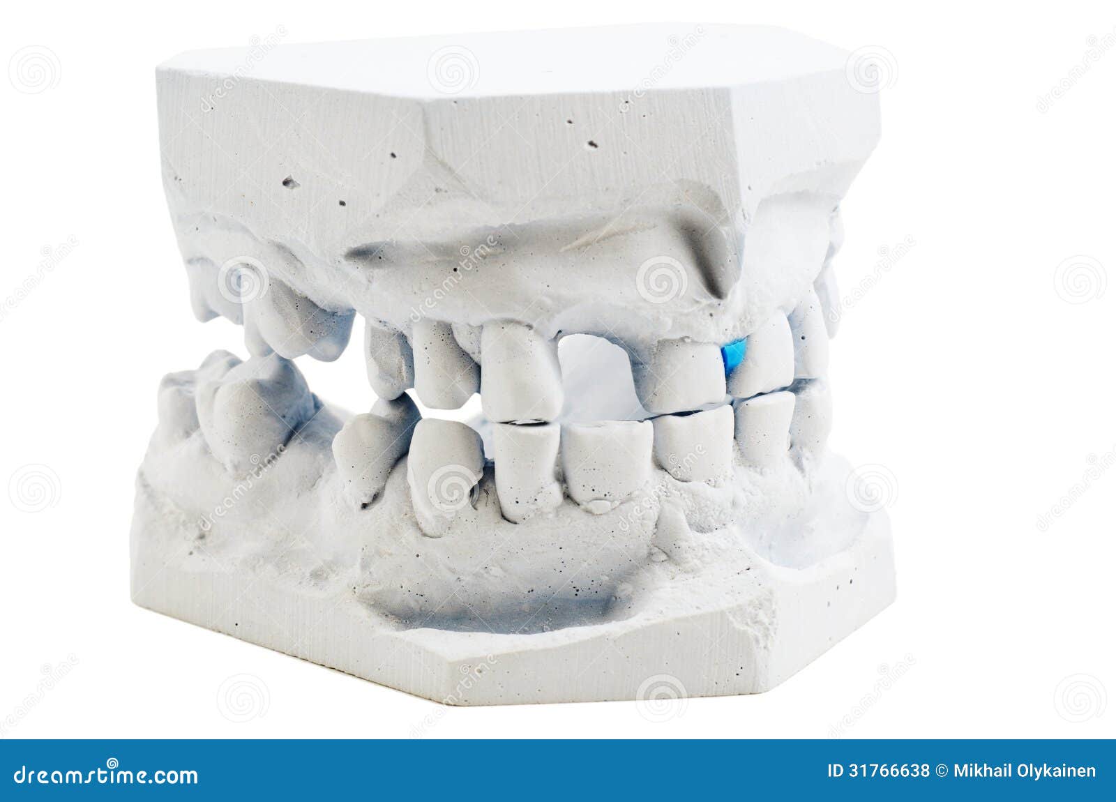 Detailed Macro of Teeth Molding Stock Photo Image of orthodontist
