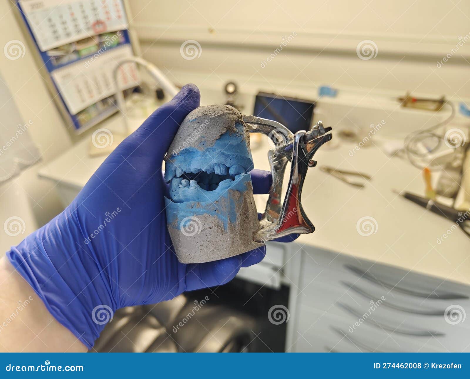 Detailed Plaster Models with Dentures Analogs in the Dental Laboratory