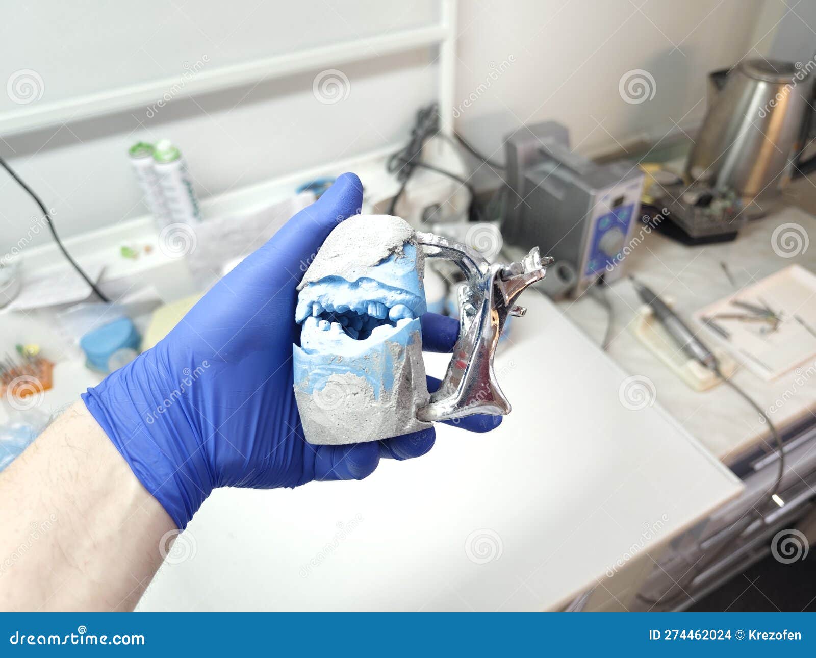 Detailed Plaster Models with Dentures Analogs in the Dental Laboratory