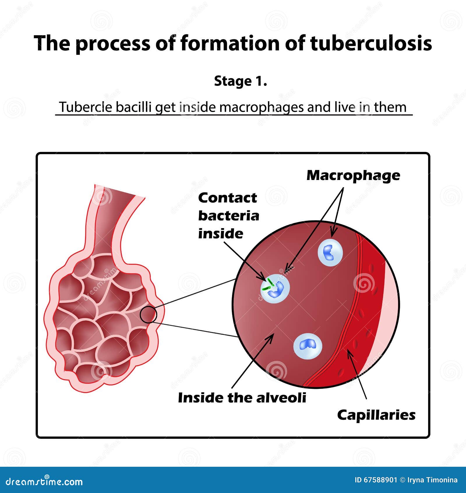 A tubercle bacillus parazita