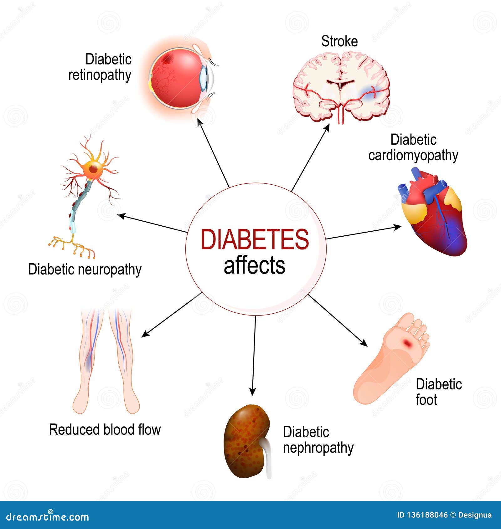 kezelés diagram diabetes mellitus 2