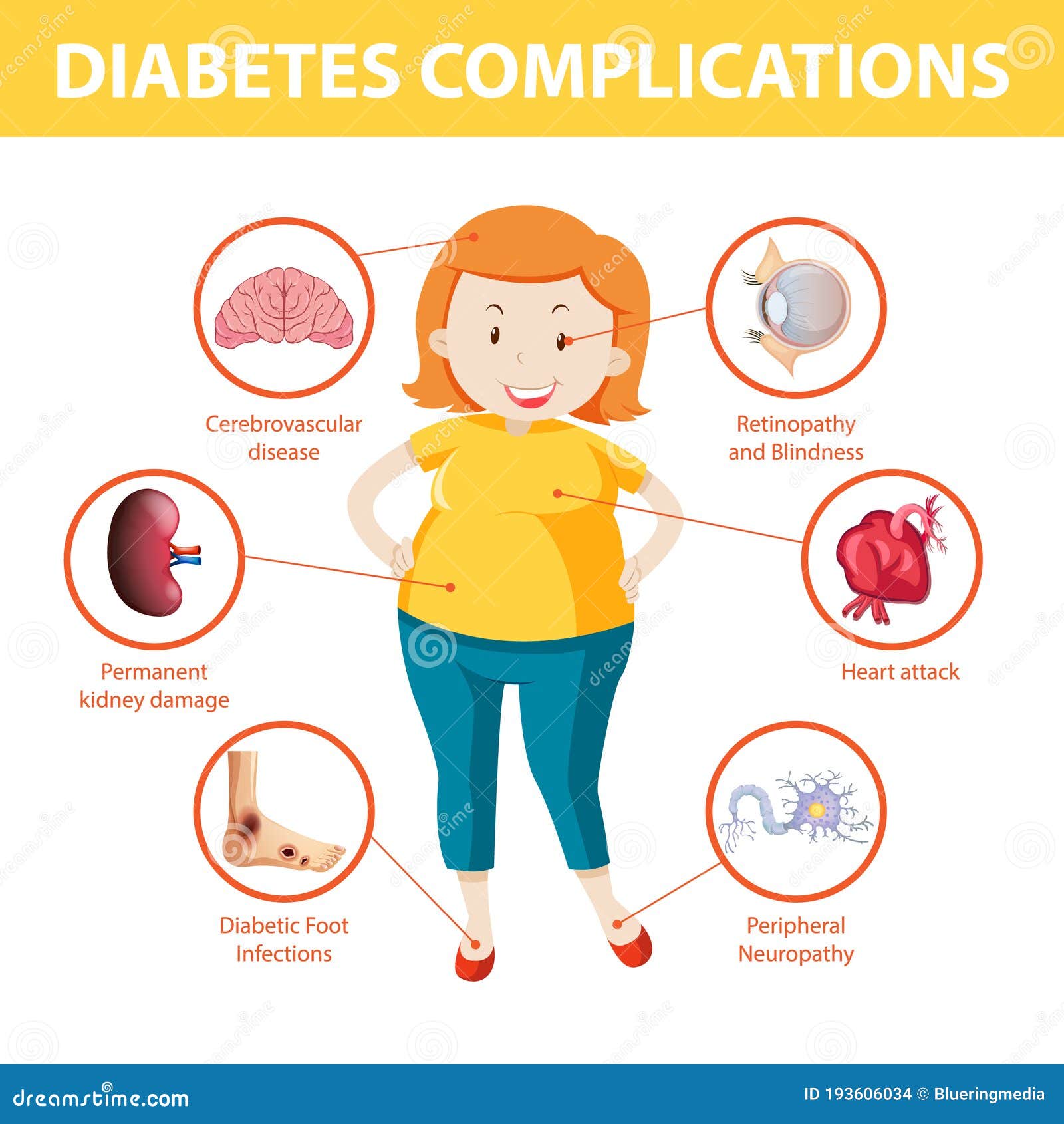 Diabetes Complications Information Infographic Stock Vector
