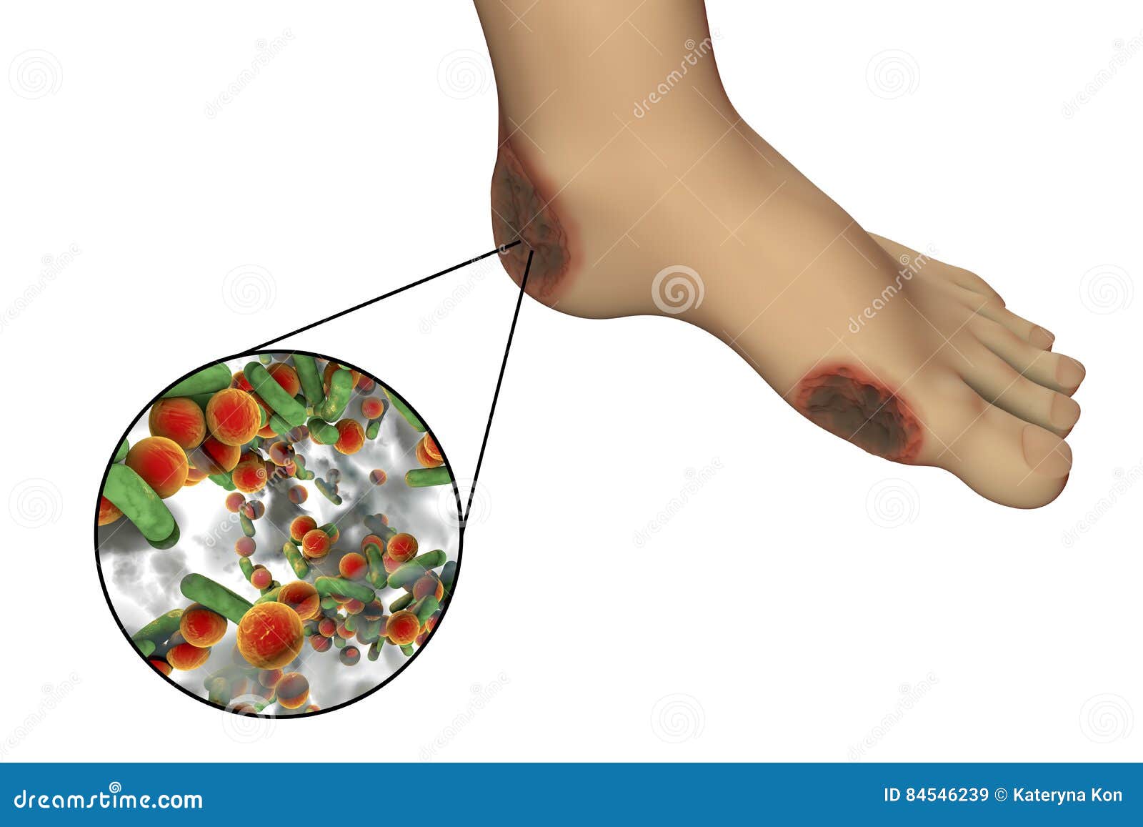 Wound Stock Illustrations – 18,234 Wound Stock Illustrations, Vectors &  Clipart - Dreamstime