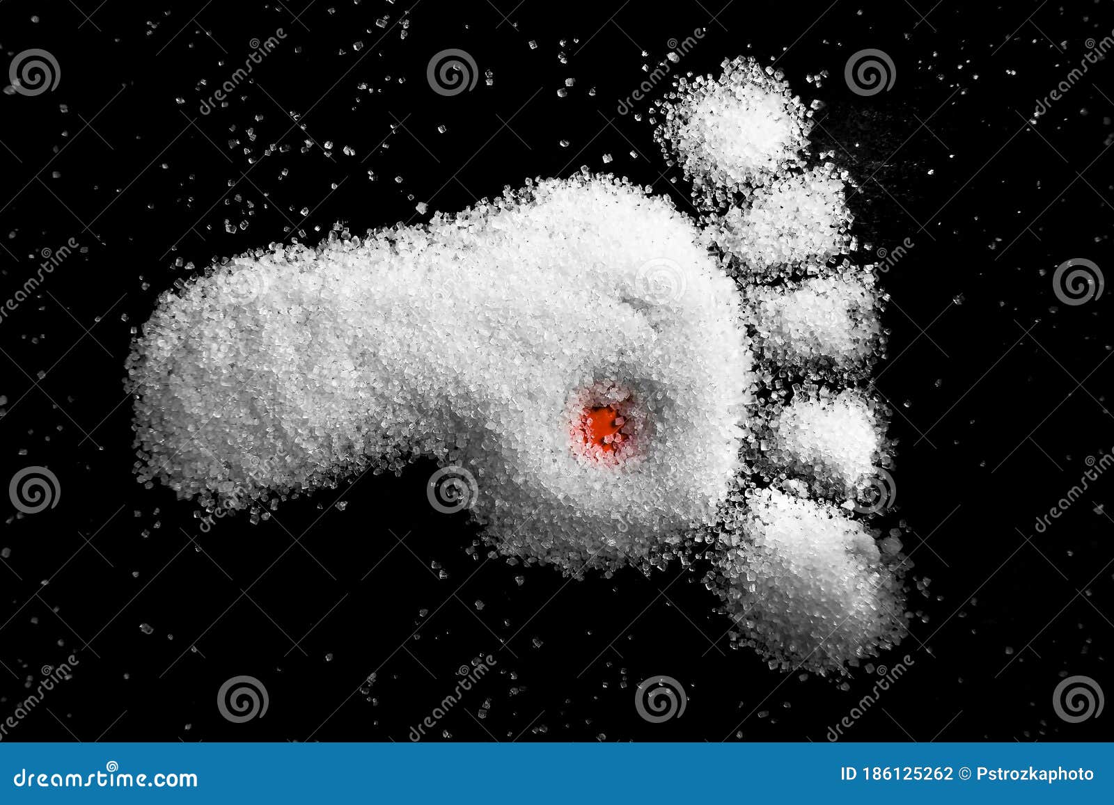 Diabetic Foot Made of Sugar Stock Photo Image of crystalline