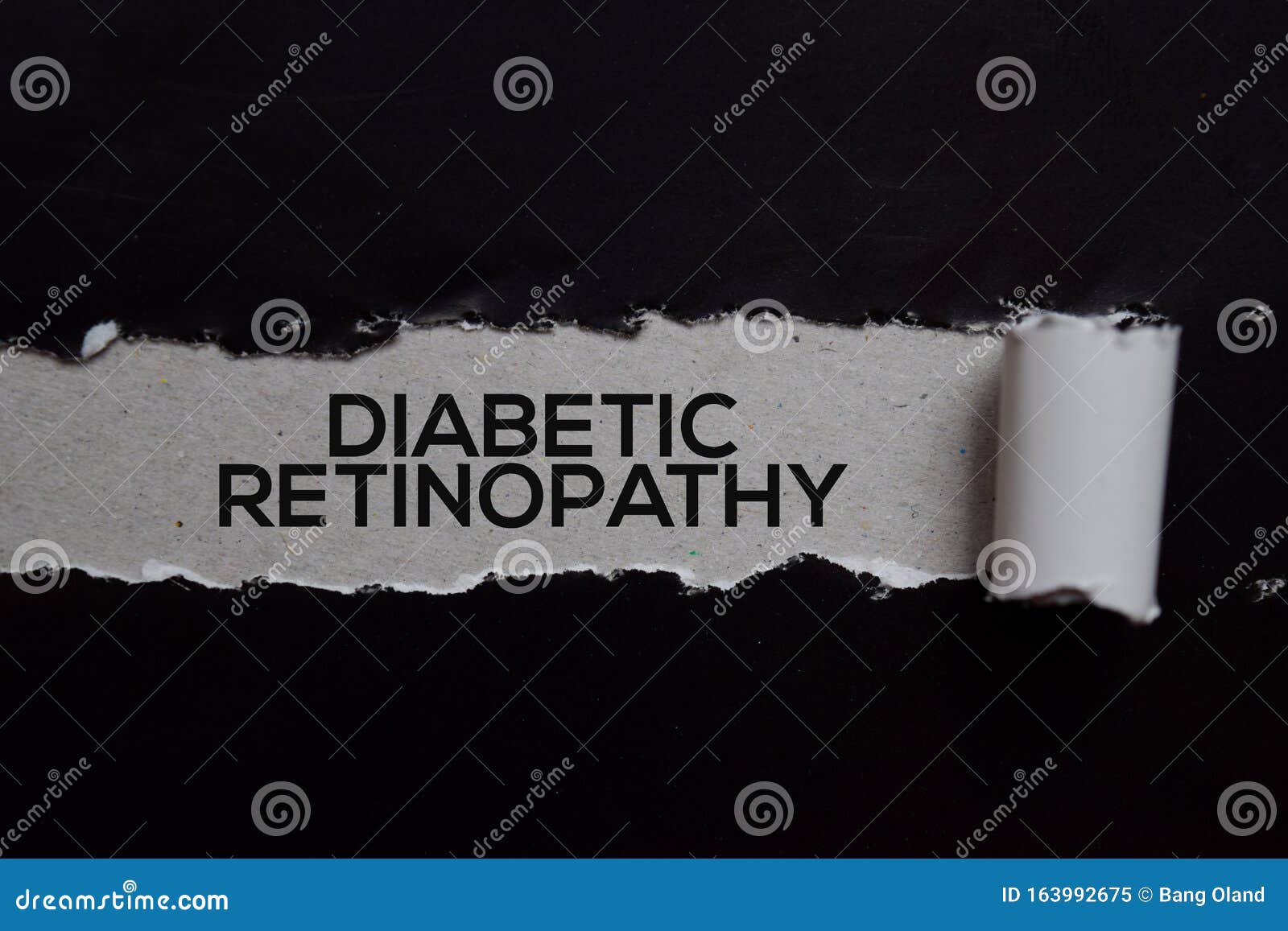 diabetic retinopathy text written in torn paper. medical concept