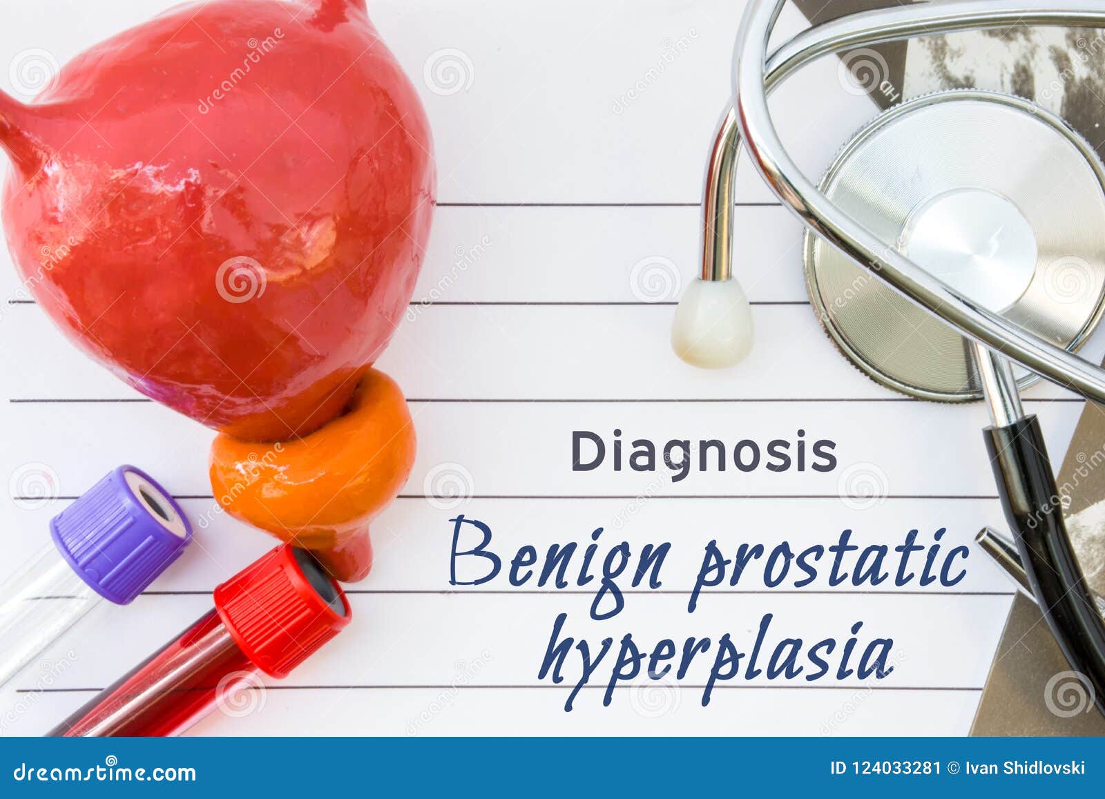 hiperplazia benigna de prostata diagnostic