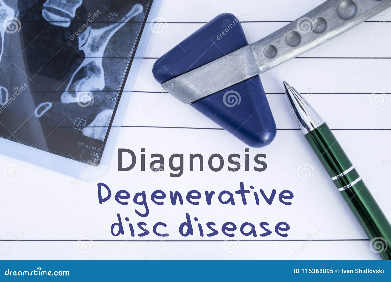 Diagnosis Degenerative Disc Disease. Medical Health History Written