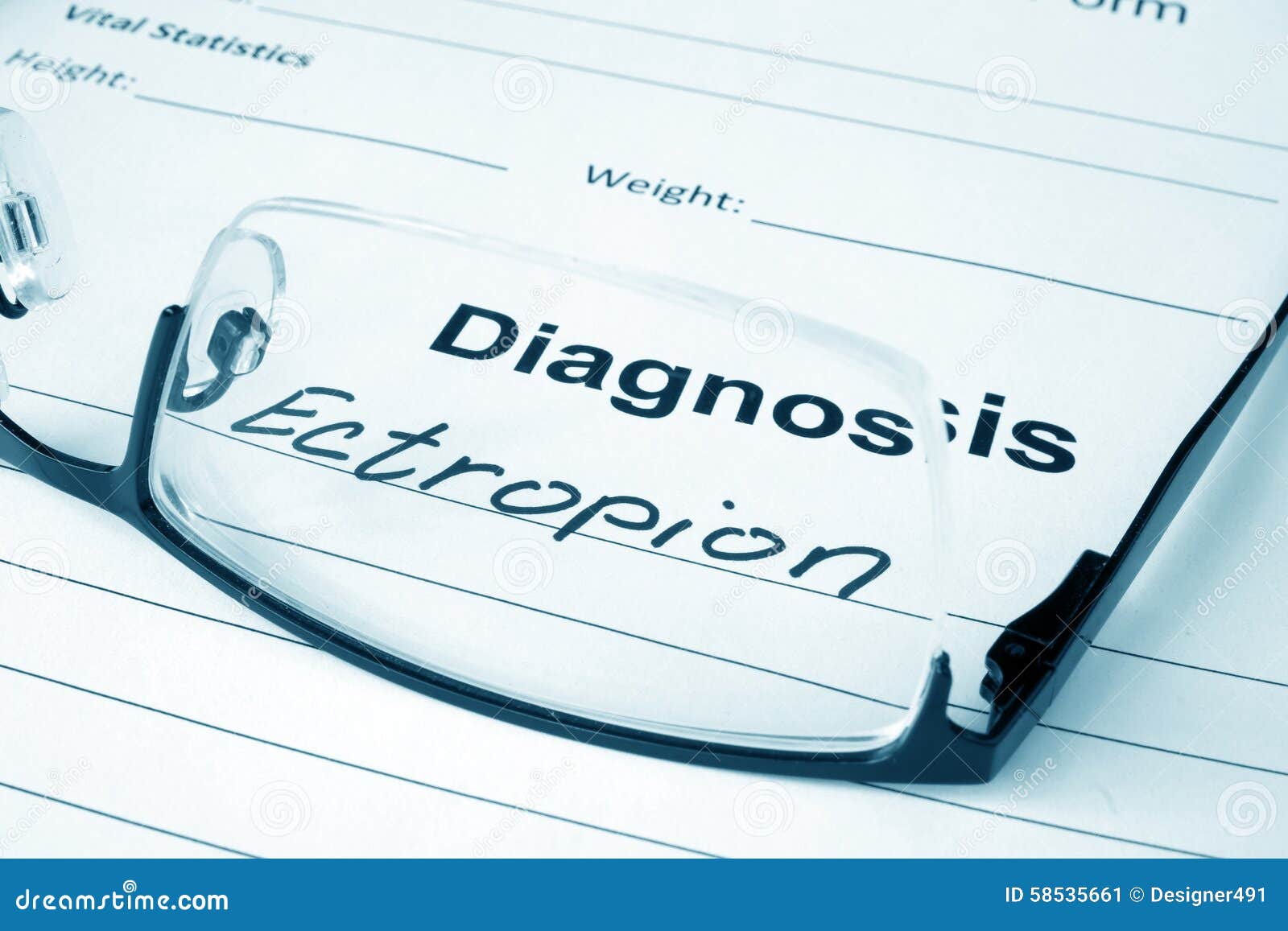 Diagnosis List with Ectropion and Glasses. Stock Image Image of