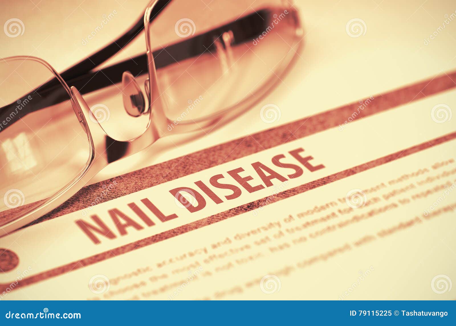 diagnosis - nail disease. medicine concept. 3d .