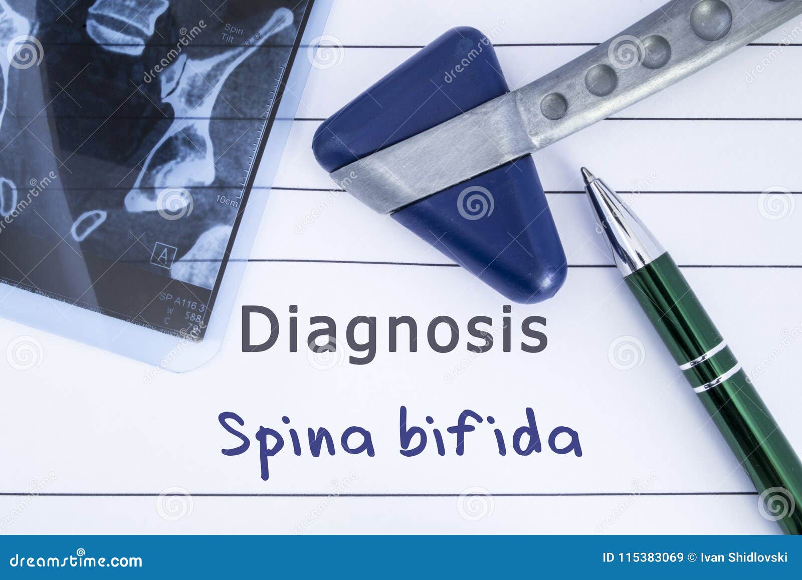 diagnosis of spina bifida. medical health history written with diagnosis of spina bifida, mri image sacral spine and neurological