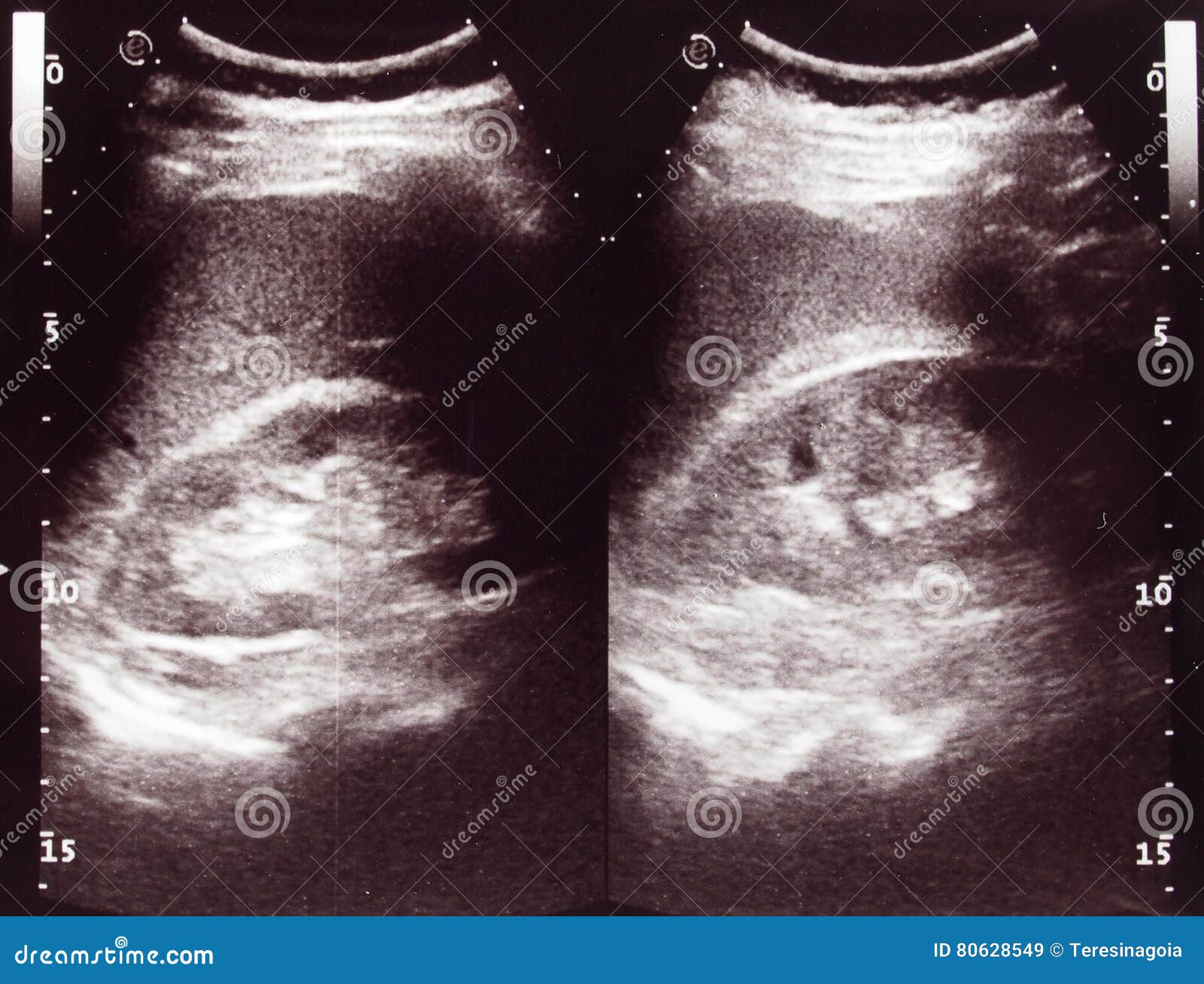 diagnostic sonography of abdomen