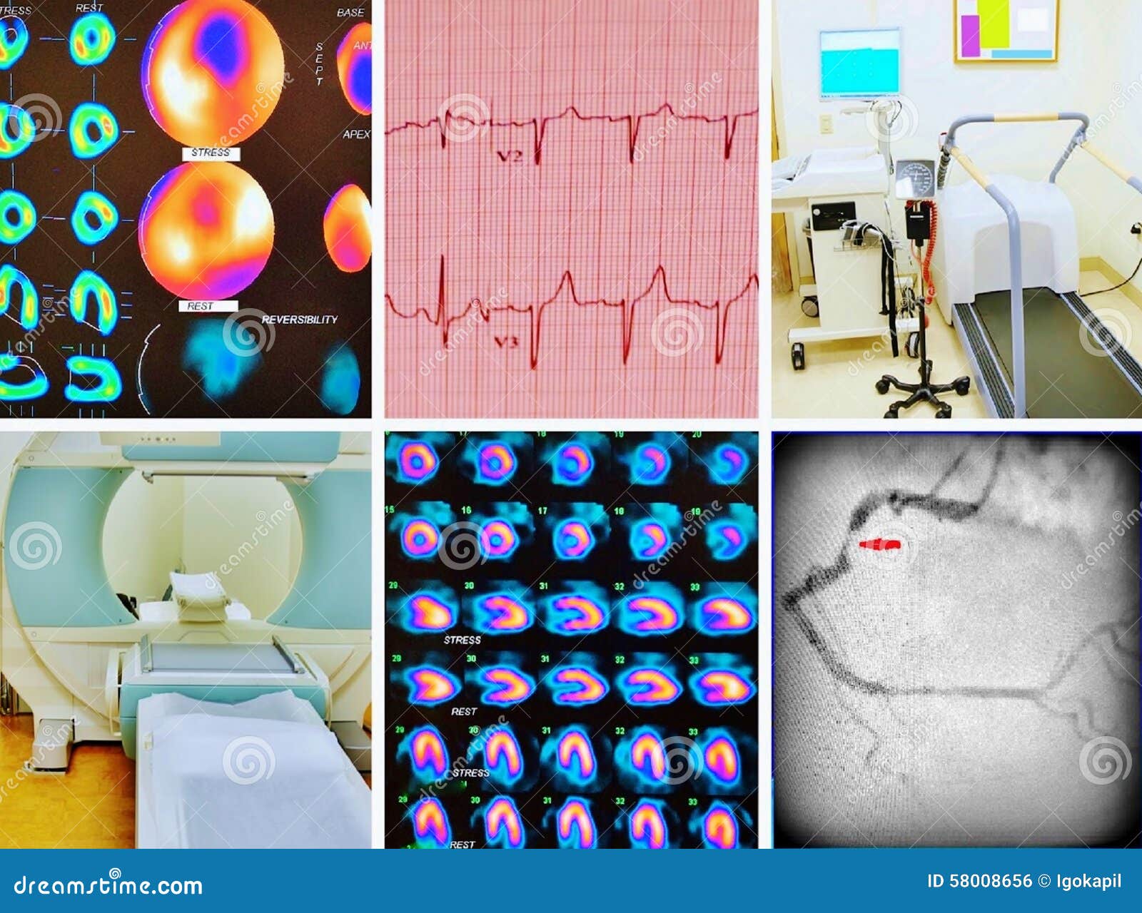 diagnostics cardiac ischemia collage