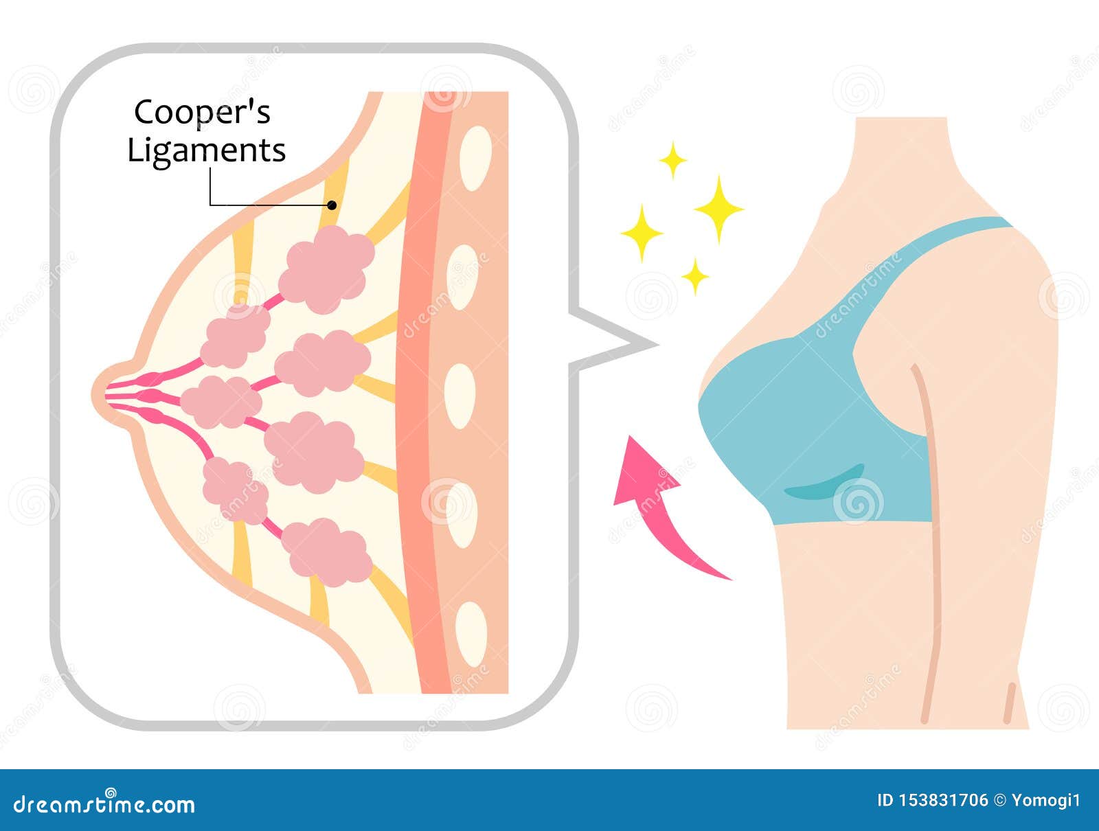 Diagram of Perky Female Boobs Illustration. Ligaments of Cooper Hold Them  and Maintain the Structure. Isolated on White Background Stock Vector -  Illustration of surgery, perky: 153831706