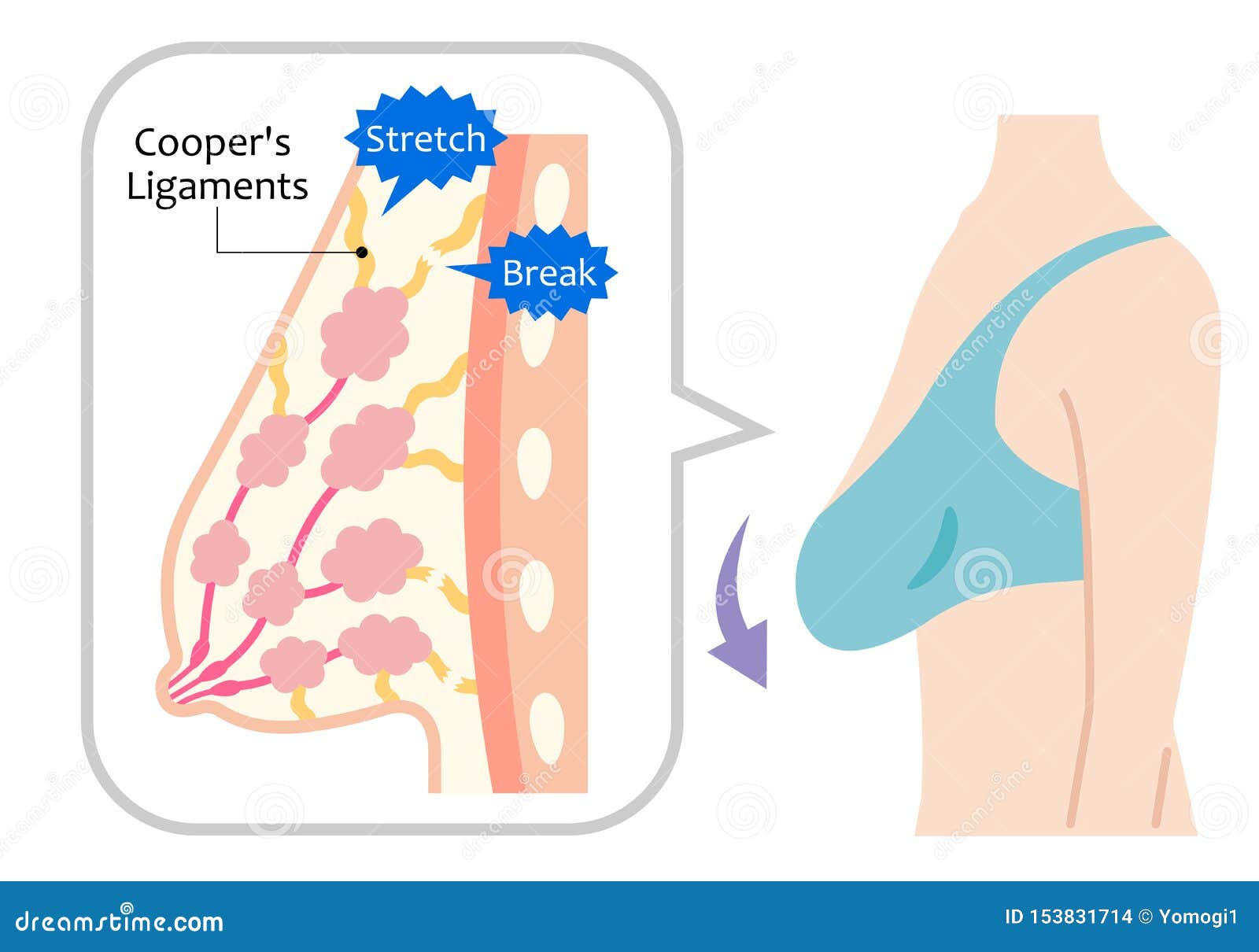 Sagging Breast Pics