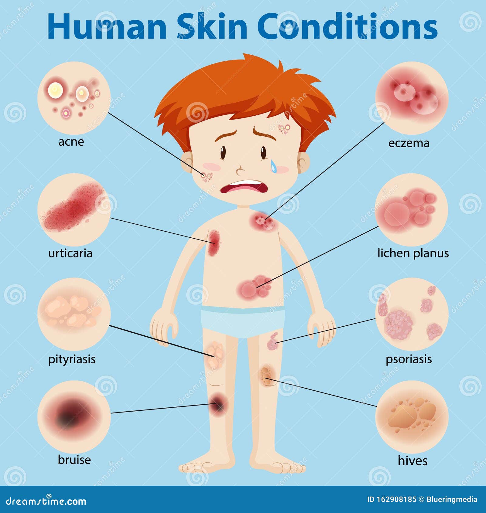 Diagram Showing Different Skin Conditions Stock Vector Illustration